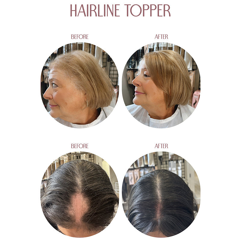 🔥Last Day:90% Off🔥Hairline Topper- Clip Free