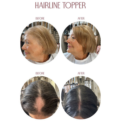 🔥Last Day:90% Off🔥Hairline Topper- Clip Free